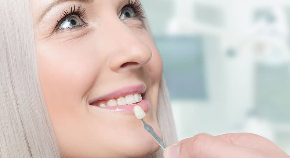 Teeth Whitening vs. Veneers: Which One is Best?