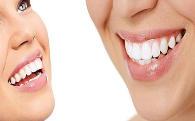 Five ways a TMJ dentist can help restore your smile